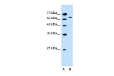 Anti-SLC22A3 antibody, N-term used in Western Blot (WB). GTX46797
