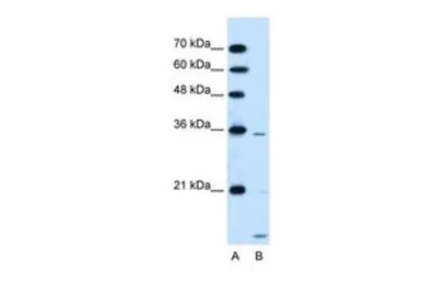 Anti-SLC25A39 antibody, C-term used in Western Blot (WB). GTX46814