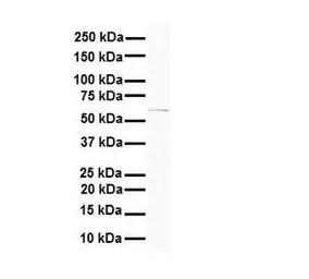 Anti-SLC7A1 antibody, N-term used in Western Blot (WB). GTX46841