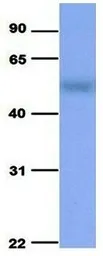 Anti-SLC37A4 antibody, Internal used in Western Blot (WB). GTX46845