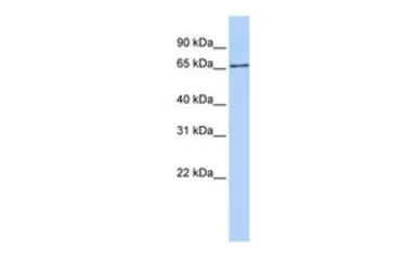 Anti-SLC27A6 antibody, Internal used in Western Blot (WB). GTX46853