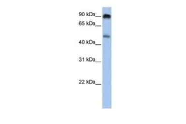 Anti-SLC45A2 antibody, C-term used in Western Blot (WB). GTX46854