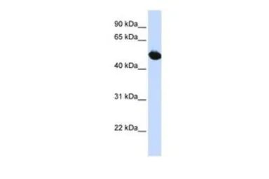 Anti-SLC2A9 antibody, Internal used in Western Blot (WB). GTX46860
