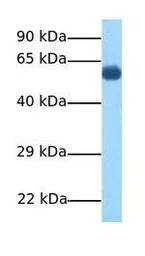 Anti-DMT1 antibody, N-term used in Western Blot (WB). GTX46861