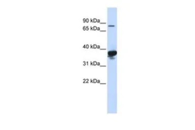 Anti-LONRF2 antibody, Internal used in Western Blot (WB). GTX46877