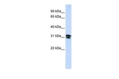 Anti-RNF182 antibody, N-term used in Western Blot (WB). GTX46883