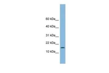 Anti-UBE2L6 antibody, Internal used in Western Blot (WB). GTX46936