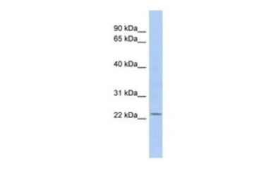 Anti-UBE2E1 antibody, Internal used in Western Blot (WB). GTX46938
