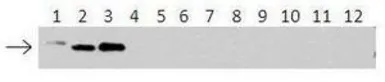 Anti-UBE2D3 antibody, N-term used in Western Blot (WB). GTX46939