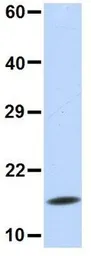 Anti-UBE2D3 antibody, N-term used in Western Blot (WB). GTX46939