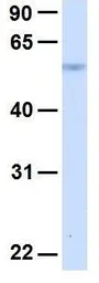 Anti-SLC19A3 antibody, Internal used in Western Blot (WB). GTX46980