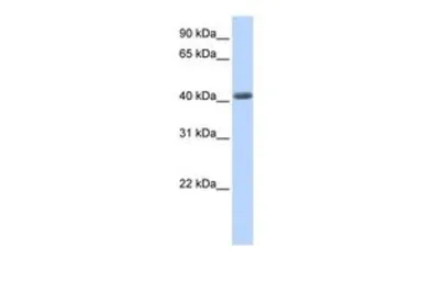 Anti-LRRC2 antibody, N-term used in Western Blot (WB). GTX46991