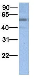 Anti-FAM46A antibody, N-term used in Western Blot (WB). GTX47012