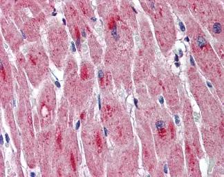 Anti-DMPK antibody, Internal used in IHC (Paraffin sections) (IHC-P). GTX47067