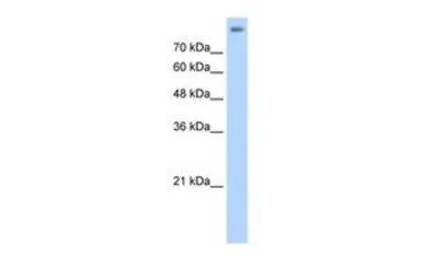 Anti-ALOX15B antibody, C-term used in Western Blot (WB). GTX47100