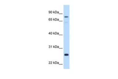 Anti-GSTM2 antibody, N-term used in Western Blot (WB). GTX47111
