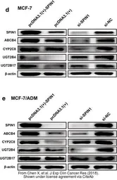 Anti-ABCB4 antibody, Internal used in Western Blot (WB). GTX47122