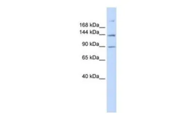 Anti-ABCB4 antibody, N-term used in Western Blot (WB). GTX47123