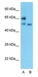 Anti-GLUT2 antibody, N-term used in Western Blot (WB). GTX47126
