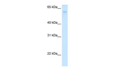 Anti-GLUT2 antibody, N-term used in Western Blot (WB). GTX47126