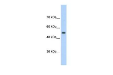 Anti-SLC13A3 antibody, Internal used in Western Blot (WB). GTX47155
