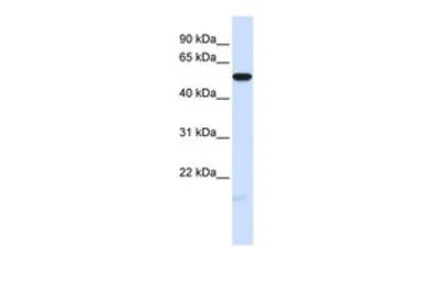 Anti-MFRP antibody, Internal used in Western Blot (WB). GTX47172