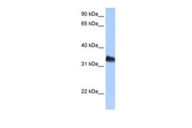 Anti-DND1 antibody, C-term used in Western Blot (WB). GTX47185