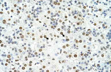 Anti-HNRNPA3 antibody, N-term used in IHC (Paraffin sections) (IHC-P). GTX47186