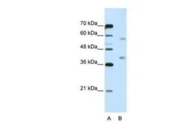 Anti-HNRNPA3 antibody, N-term used in Western Blot (WB). GTX47186