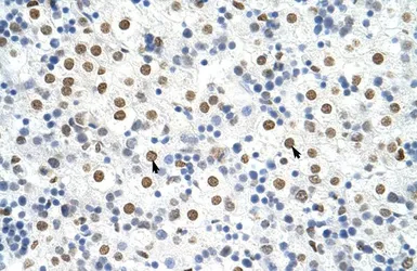 Anti-HNRNPA3 antibody, N-term used in IHC (Paraffin sections) (IHC-P). GTX47187