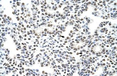 Anti-HNRNPA3 antibody, N-term used in IHC (Paraffin sections) (IHC-P). GTX47187