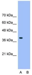 Anti-HNRNPA3 antibody, N-term used in Western Blot (WB). GTX47187