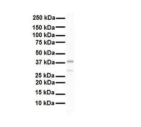 Anti-HNRNPA3 antibody, N-term used in Western Blot (WB). GTX47187