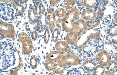 Anti-APOBEC3D antibody, N-term used in IHC (Paraffin sections) (IHC-P). GTX47206