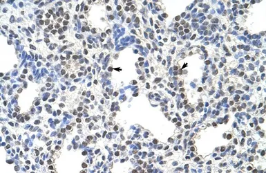 Anti-FUSIP1 antibody, C-term used in IHC (Paraffin sections) (IHC-P). GTX47232