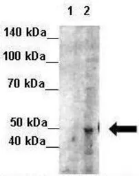 Anti-NXF5 antibody, Internal used in Western Blot (WB). GTX47238