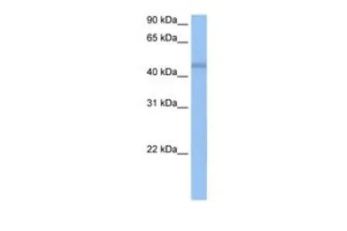 Anti-DKFZP564O0523 antibody, C-term used in Western Blot (WB). GTX47241