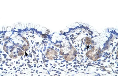 Anti-UPF3B antibody, N-term used in IHC (Paraffin sections) (IHC-P). GTX47258