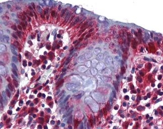 Anti-RBM47 antibody, Internal used in IHC (Paraffin sections) (IHC-P). GTX47272