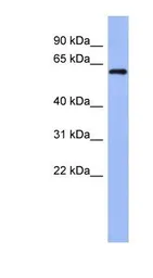 Anti-RBM47 antibody, Internal used in Western Blot (WB). GTX47272