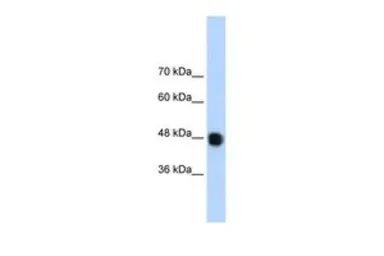 Anti-DAZAP1 antibody, C-term used in Western Blot (WB). GTX47274