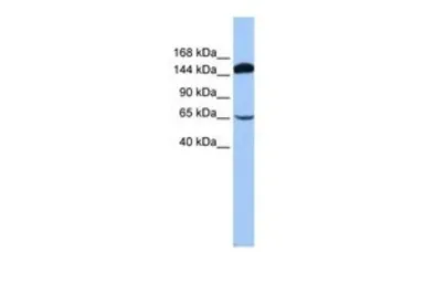 Anti-SRBD1 antibody, N-term used in Western Blot (WB). GTX47284