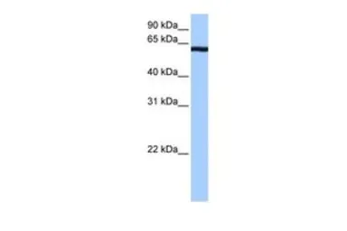 Anti-CSTF2T antibody, C-term used in Western Blot (WB). GTX47310