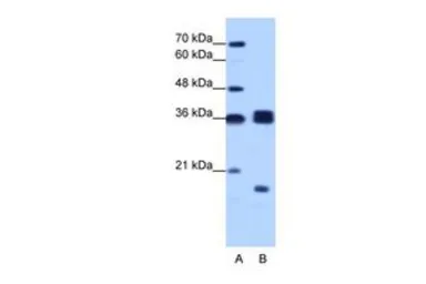 Anti-HNRPH3 antibody, N-term used in Western Blot (WB). GTX47329