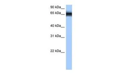 Anti-hnRNP M antibody, N-term used in Western Blot (WB). GTX47353