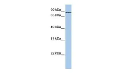 Anti-SF3A1 antibody, N-term used in Western Blot (WB). GTX47356