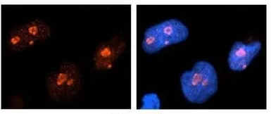 Anti-Nucleolin antibody, C-term used in Immunocytochemistry/ Immunofluorescence (ICC/IF). GTX47363