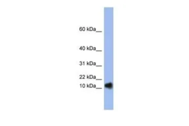 Anti-Ribonuclease A antibody, N-term used in Western Blot (WB). GTX47387