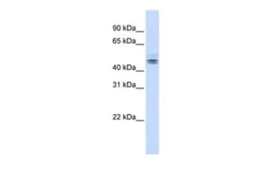 Anti-NELF-E antibody, N-term used in Western Blot (WB). GTX47389