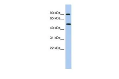 Anti-PRMT7 antibody, N-term used in Western Blot (WB). GTX47432